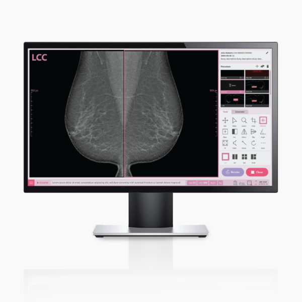 detector-de-panel-plano-VIVIX-M-1008S-mamografia-software